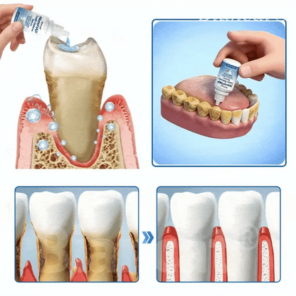 GermanyL™ NanoHAP Tooth Defense Serum (Buy 1 Get 1 Free)